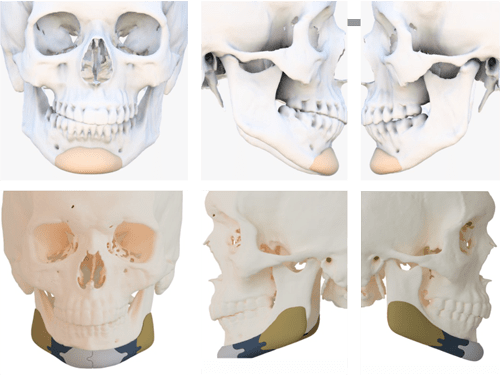 Imagens dos ossos da face para cirurgia ortognática com Dr. Rogério Zambonato